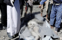 Suudi Arabistan Yemen'i vurdu: 51 ölü