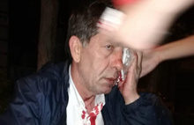 Saldırıya uğrayan gazeteci Demirağ'ın son durumu