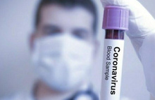 Dünyanın sayılı uzmanlarından Prof. Dr. Derya Unutmaz koronavirüsle ilgili güzel haberi verdi