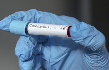 Uzmanlar cevapladı: Koronavirüs salgını ne zaman bitecek?