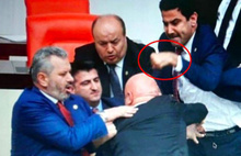AKP'li vekilin eli, CHP'li Engin Özkoç'a attığı yumruk nedeniyle üç yerden kırıldı