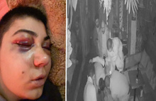 Eğlence Mekanında Dövülen Kadının Yüzünde Felç Tehlikesi