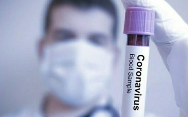 Dünyanın sayılı uzmanlarından Prof. Dr. Derya Unutmaz koronavirüsle ilgili güzel haberi verdi