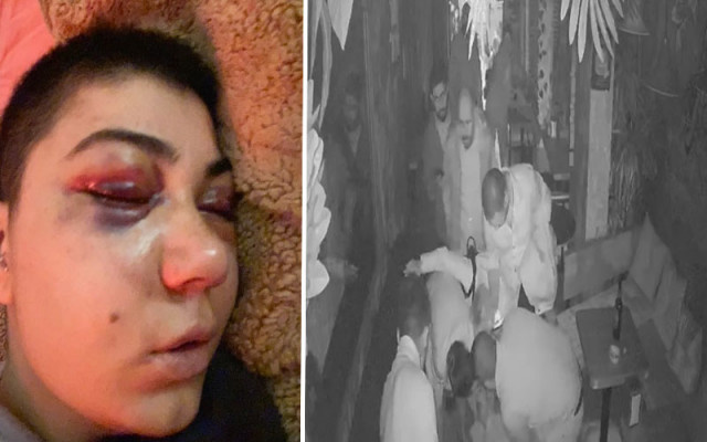 Eğlence Mekanında Dövülen Kadının Yüzünde Felç Tehlikesi