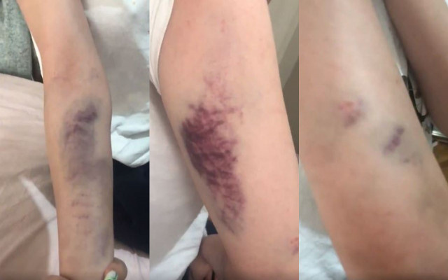 Güvenlik Görevlisi Eski Sevgili İki Kız arkadaşı Otel Tuvaletinde dövdü