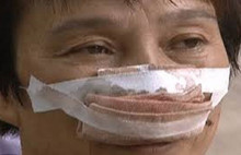 Telefona çıkmayan karısının burnunu yuttu!