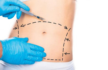 Telefonda obezite ameliyatı pazarlığı