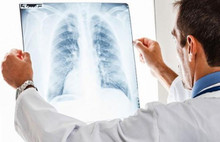 Akciğer kanserinde büyük umut