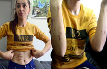 Güzellik merkezinde kabusu yaşadı