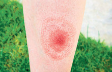 Uzmanlar uyarıyor: Çağın salgını