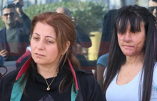 Yüzüne asit atılan Berfin: Yaşadığım şeyler kolay değildi. Kadına yönelik şiddet son bulsun