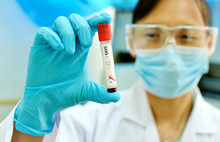 Corona virüsünden iyi haber geldi