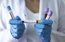 Türkiye'deki koronavirüs vaka sayısı 98'e yükseldi