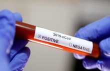 Test sonuçlarının ulaşılacağı adres açıklandı