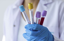 7 Acil önlem çağrısı!