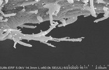 Sinsi virüs böyle görüntülendi