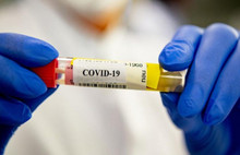 Fahrettin Koca'nın açıkladığı veriler çelişkili mi ?