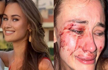 Ünlü model İzmir’de saldırıya uğradı