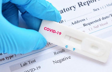 Covid test kitlerinin tek yetkili firması umre ve hac organizatörü çıktı!