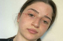 Başörtüsü Takmak İstemeyen Hilal'i Babası Bu Hale Getirdi