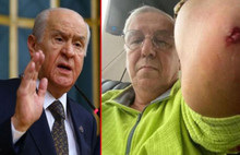 Bahçeli Hakkında Bir Suç Duyurusu Daha...
