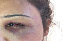 Gamze Medyada Adalet Arıyor: #GamzeyeYardımEdin