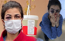 Melek İpek'in Kocası Seri İşkenceci Çıktı