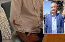 Didim Belediye Başkanına beyzbol sopalı saldırı!