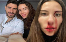 Karısını Darp Eden Futbolcu Özer Hurmacı Hakkında Flaş Karar