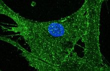 53 Yaşındaki Kadının Cildi 23 Yaşına Gençleştirildi