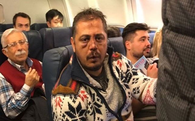 Kiev kabusu : Onlarca yaralı var…