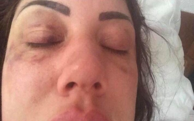 İngiliz turist dehşeti yaşadı