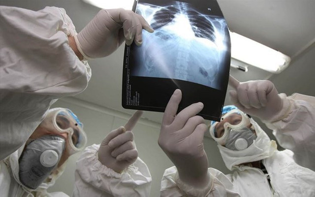 Dünyada virüs paniği! Fransa'da en az iki kişiye bulaştığı belirlendi