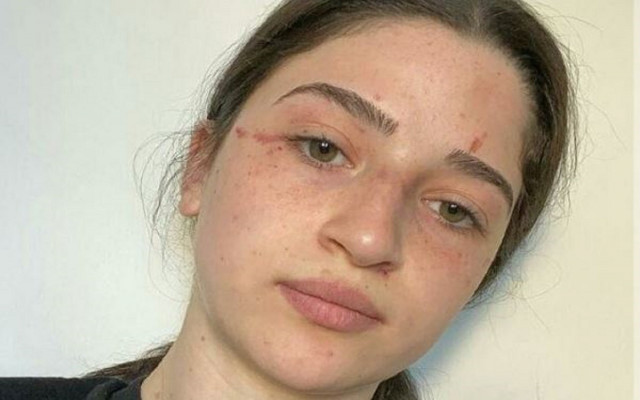 Başörtüsü Takmak İstemeyen Hilal'i Babası Bu Hale Getirdi