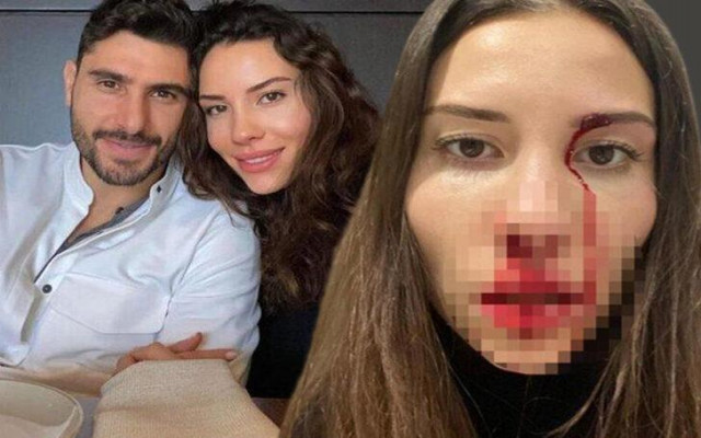 Karısını Darp Eden Futbolcu Özer Hurmacı Hakkında Flaş Karar