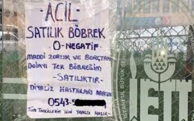 Böbrek Satma ilanları trendlerde...